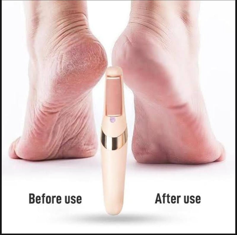 Rechargeable Electric Pedi Foot Filer Effective Callus Remover For Soft Smooth Feet With Easy Use, photo 3